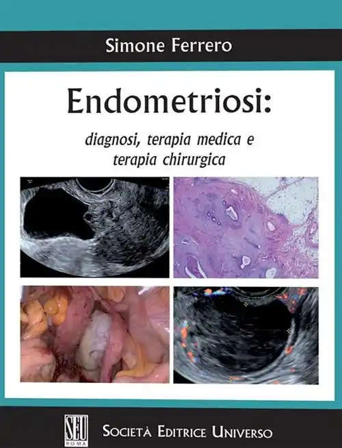 Endometriosi diagnosi, terapia medica e terapia chirurgica Occasione