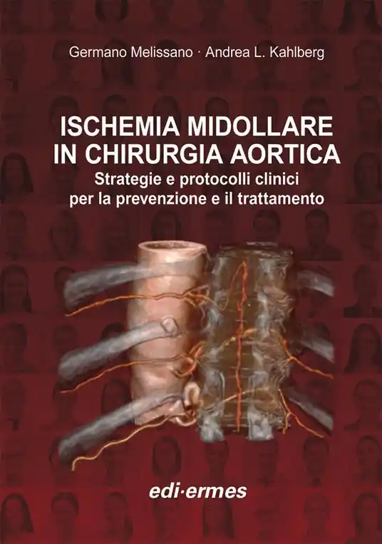 Di Tendenza Ischemia midollare in chirurgia aortica. Strategie e protocolli clinici per la prevenzione e il trattamento