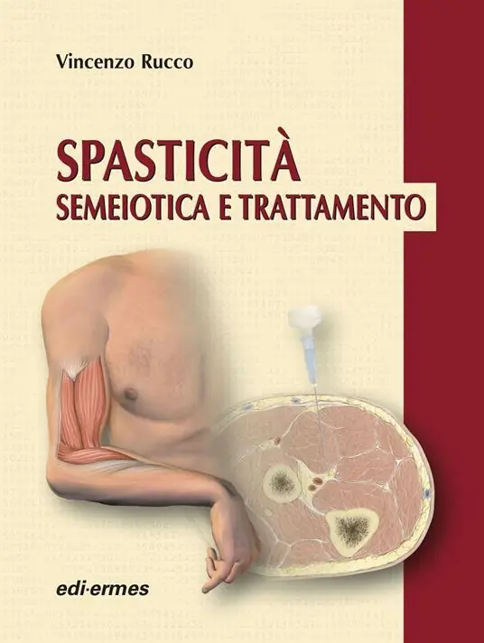 Spasticità. Semeiotica e trattamento Nuova Collezione