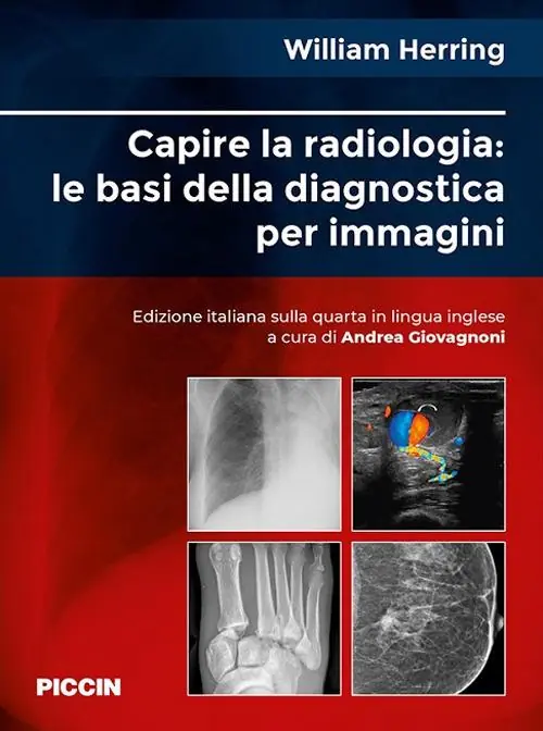 Capire la radiologia le basi della diagnostica per immagini Esclusivo