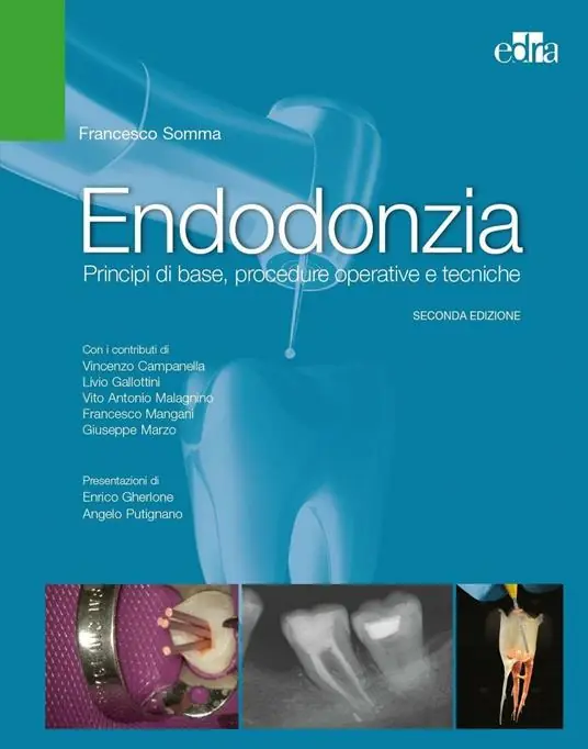 Soddisfatti O Rimborsati Endodonzia. Principi di base, procedure operative e tecniche