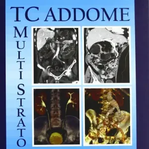 TC multistrato dell‘addome Novità