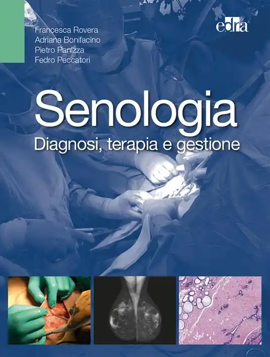 Senologia. Diagnosi, terapia e gestione Miglior Prezzo