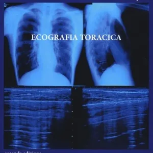 Reso Gratuito Ecografia toracica. Con CD-ROM