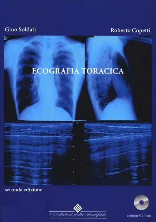 Reso Gratuito Ecografia toracica. Con CD-ROM