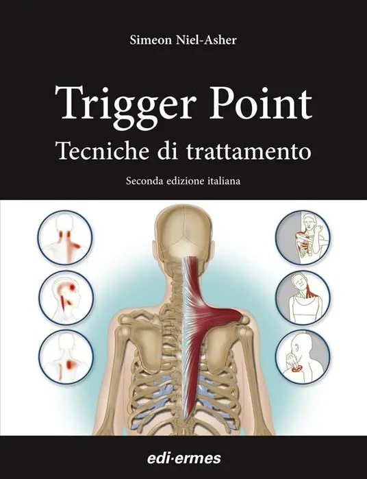 Spedizione Espresso Trigger point. Tecniche di trattamento