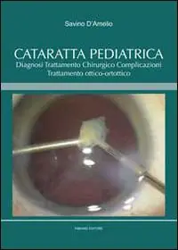 Compra Oggi Stesso Cataratta pediatrica. Diagnosi, trattamento chirurgico, complicazioni, trattamento ottico-ortottico